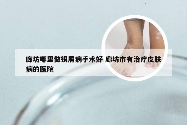廊坊哪里做银屑病手术好 廊坊市有治疗皮肤病的医院