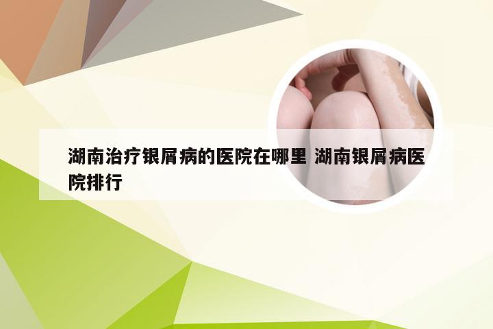 湖南治疗银屑病的医院在哪里 湖南银屑病医院排行