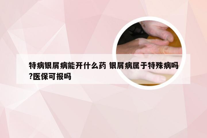 特病银屑病能开什么药 银屑病属于特殊病吗?医保可报吗