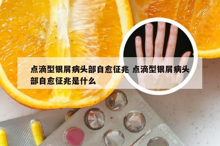 点滴型银屑病头部自愈征兆 点滴型银屑病头部自愈征兆是什么