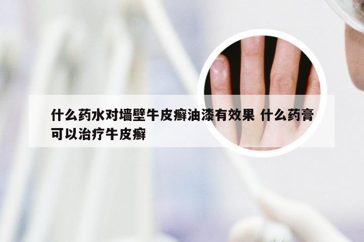 什么药水对墙壁牛皮癣油漆有效果 什么药膏可以治疗牛皮癣