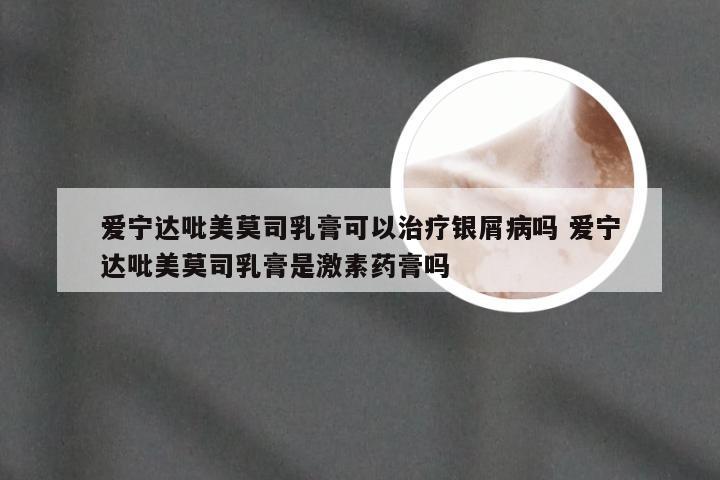 爱宁达吡美莫司乳膏可以治疗银屑病吗 爱宁达吡美莫司乳膏是激素药膏吗