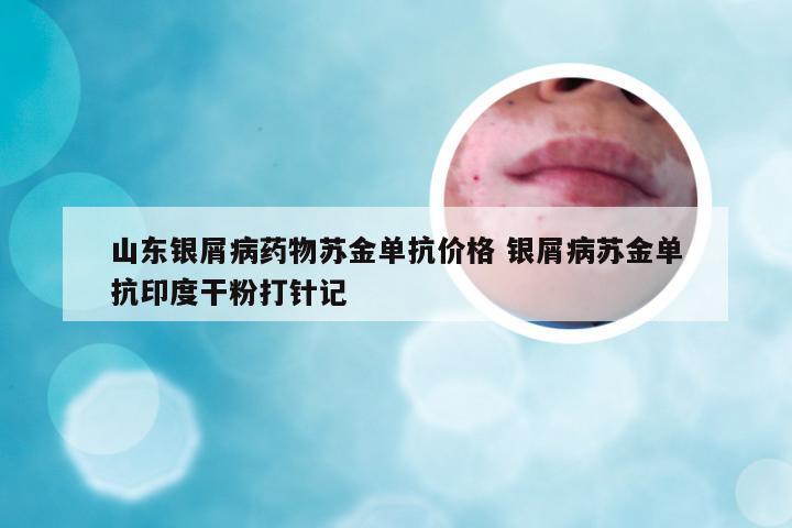 山东银屑病药物苏金单抗价格 银屑病苏金单抗印度干粉打针记