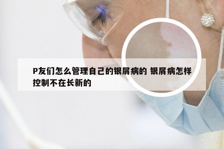 P友们怎么管理自己的银屑病的 银屑病怎样控制不在长新的