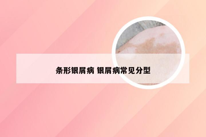 条形银屑病 银屑病常见分型