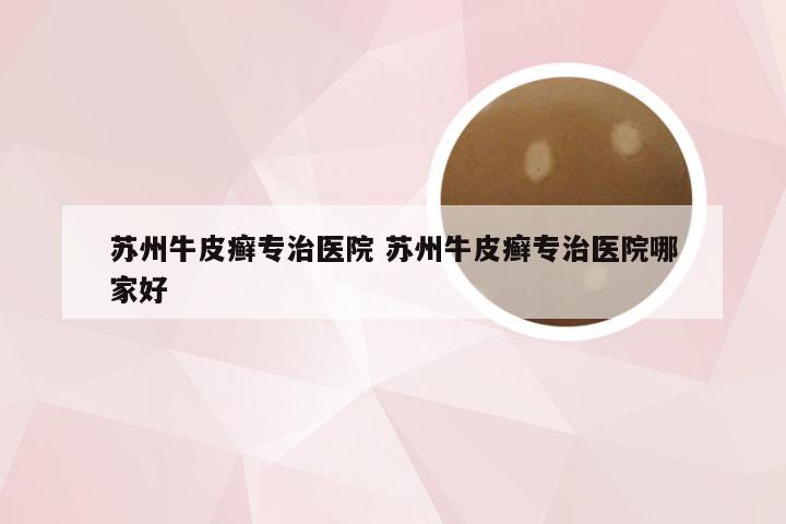 苏州牛皮癣专治医院 苏州牛皮癣专治医院哪家好