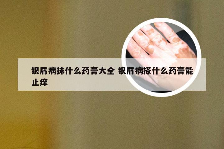 银屑病抹什么药膏大全 银屑病搽什么药膏能止痒