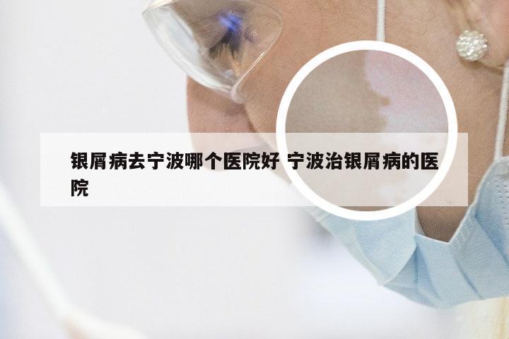 银屑病去宁波哪个医院好 宁波治银屑病的医院