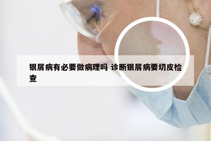 银屑病有必要做病理吗 诊断银屑病要切皮检查