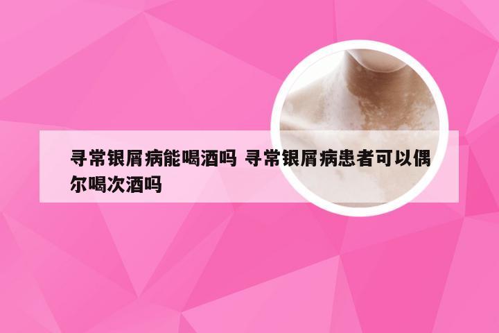 寻常银屑病能喝酒吗 寻常银屑病患者可以偶尔喝次酒吗