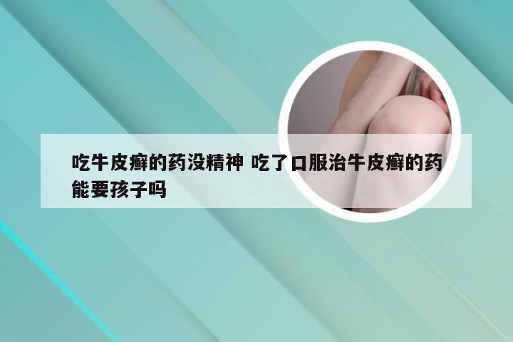 吃牛皮癣的药没精神 吃了口服治牛皮癣的药能要孩子吗