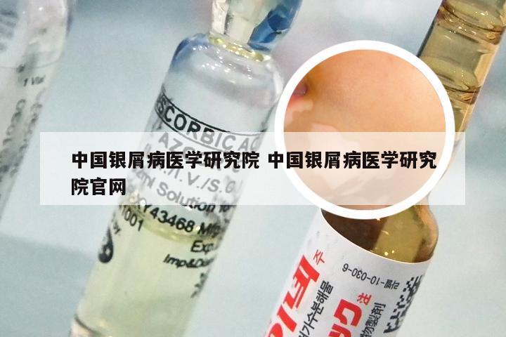 中国银屑病医学研究院 中国银屑病医学研究院官网