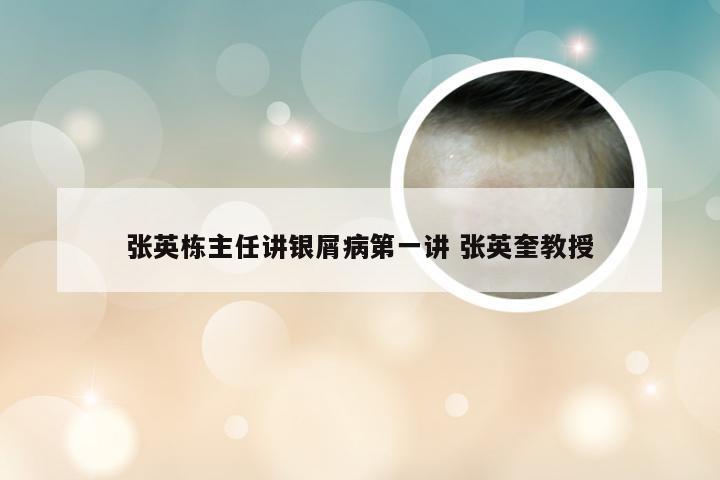 张英栋主任讲银屑病第一讲 张英奎教授