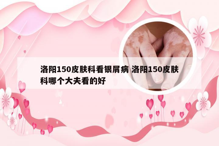 洛阳150皮肤科看银屑病 洛阳150皮肤科哪个大夫看的好