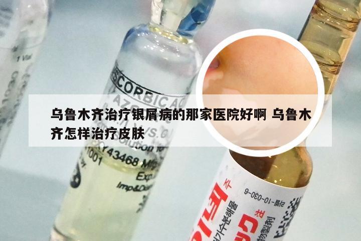 乌鲁木齐治疗银屑病的那家医院好啊 乌鲁木齐怎样治疗皮肤