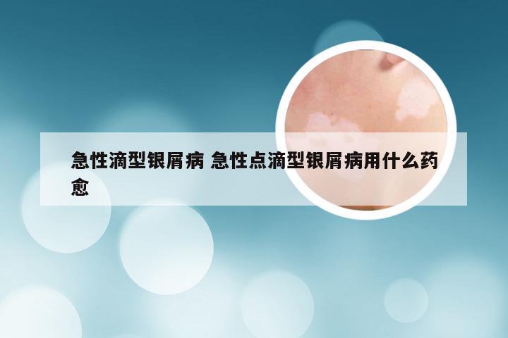 急性滴型银屑病 急性点滴型银屑病用什么药愈