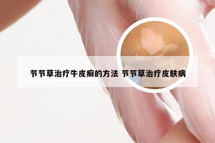 节节草治疗牛皮癣的方法 节节草治疗皮肤病