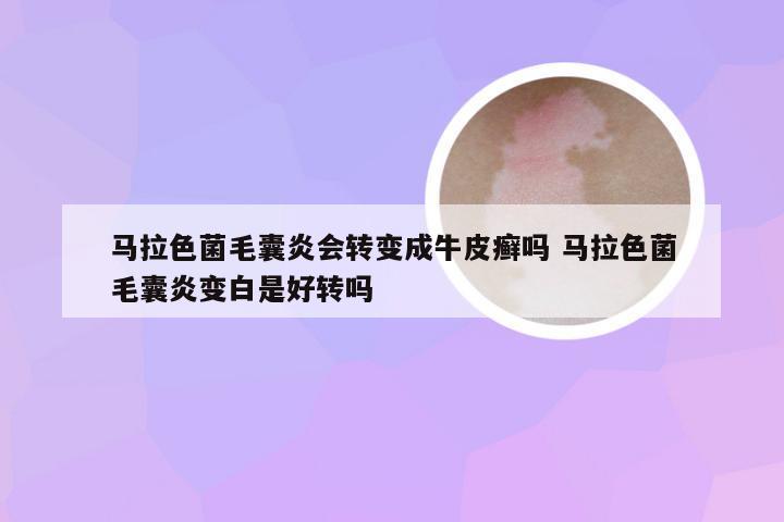 马拉色菌毛囊炎会转变成牛皮癣吗 马拉色菌毛囊炎变白是好转吗