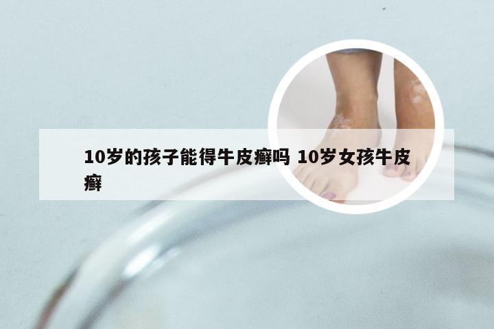 10岁的孩子能得牛皮癣吗 10岁女孩牛皮癣