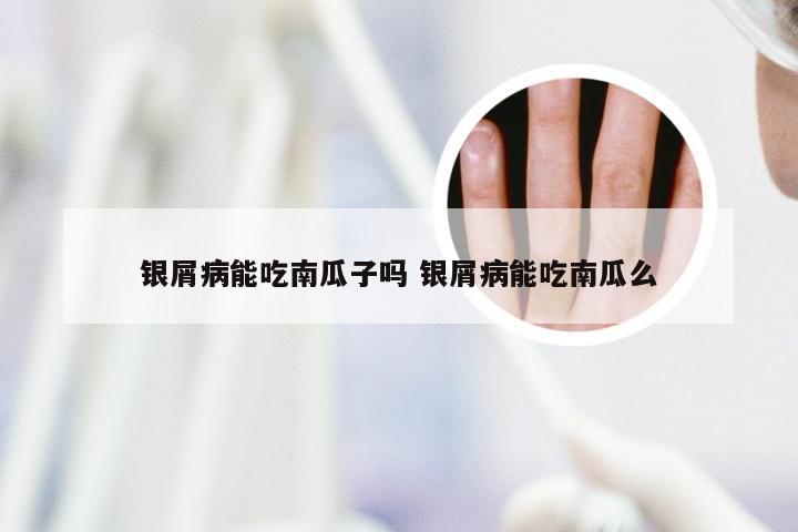 银屑病能吃南瓜子吗 银屑病能吃南瓜么