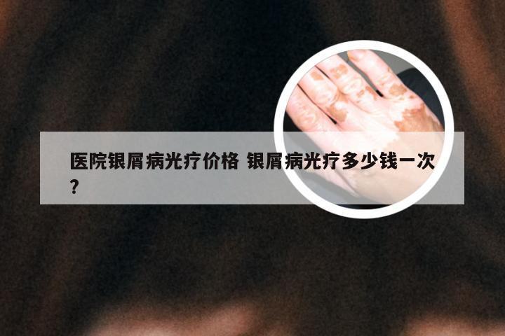 医院银屑病光疗价格 银屑病光疗多少钱一次?