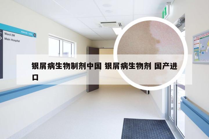 银屑病生物制剂中国 银屑病生物剂 国产进口