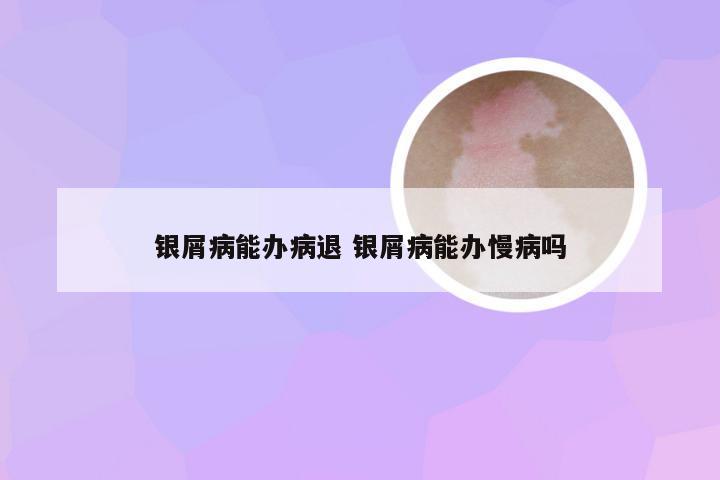 银屑病能办病退 银屑病能办慢病吗