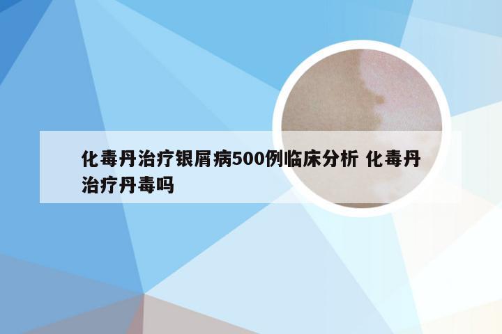 化毒丹治疗银屑病500例临床分析 化毒丹治疗丹毒吗