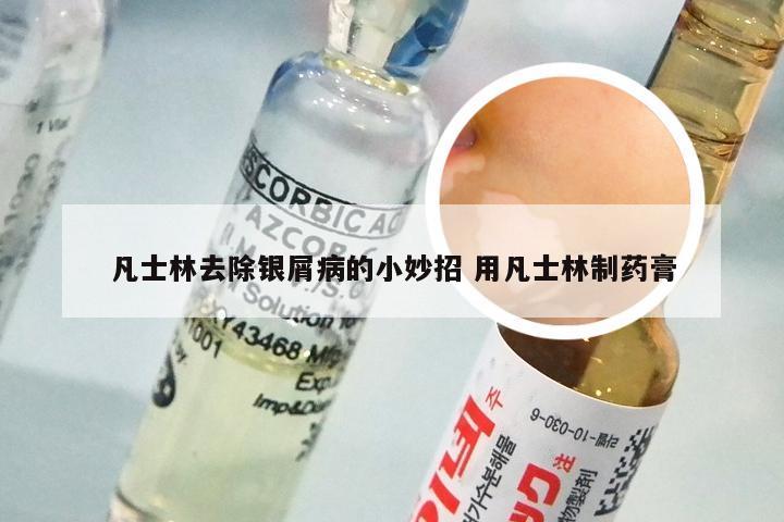 凡士林去除银屑病的小妙招 用凡士林制药膏