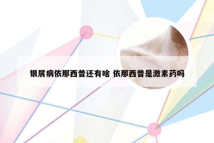 银屑病依那西普还有啥 依那西普是激素药吗