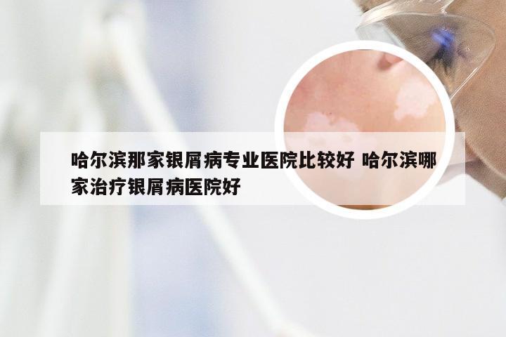 哈尔滨那家银屑病专业医院比较好 哈尔滨哪家治疗银屑病医院好