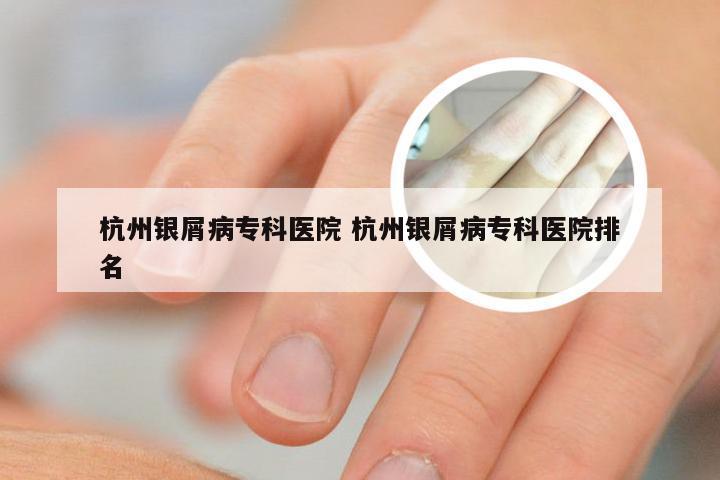 杭州银屑病专科医院 杭州银屑病专科医院排名