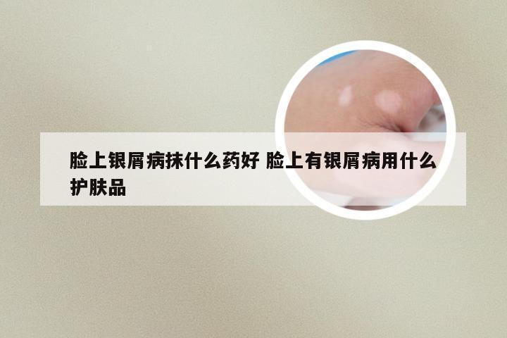 脸上银屑病抹什么药好 脸上有银屑病用什么护肤品