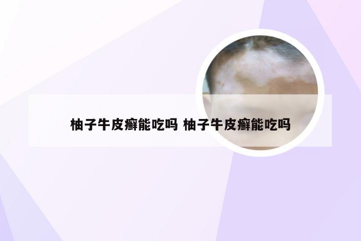 柚子牛皮癣能吃吗 柚子牛皮癣能吃吗