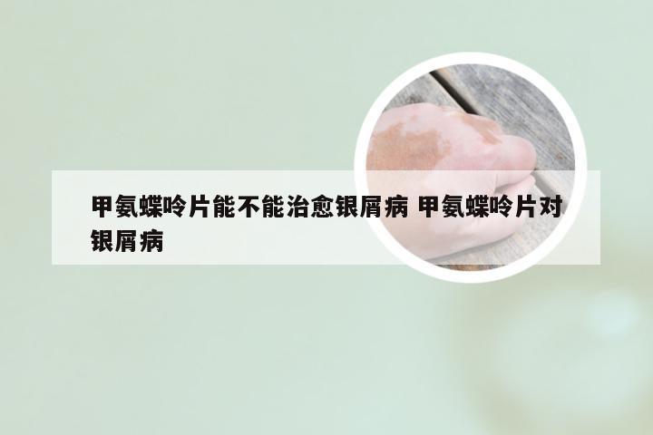 甲氨蝶呤片能不能治愈银屑病 甲氨蝶呤片对银屑病