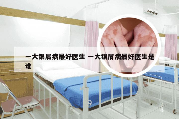 一大银屑病最好医生 一大银屑病最好医生是谁