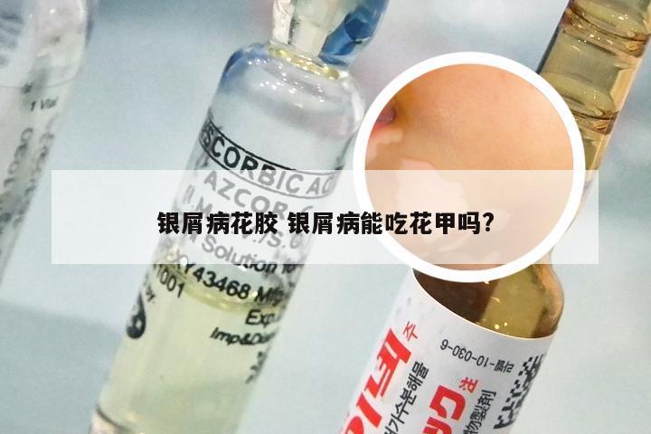 银屑病花胶 银屑病能吃花甲吗?