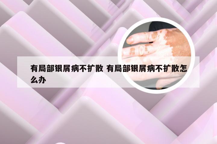 有局部银屑病不扩散 有局部银屑病不扩散怎么办