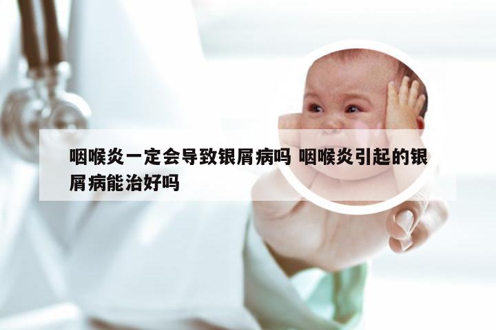 咽喉炎一定会导致银屑病吗 咽喉炎引起的银屑病能治好吗