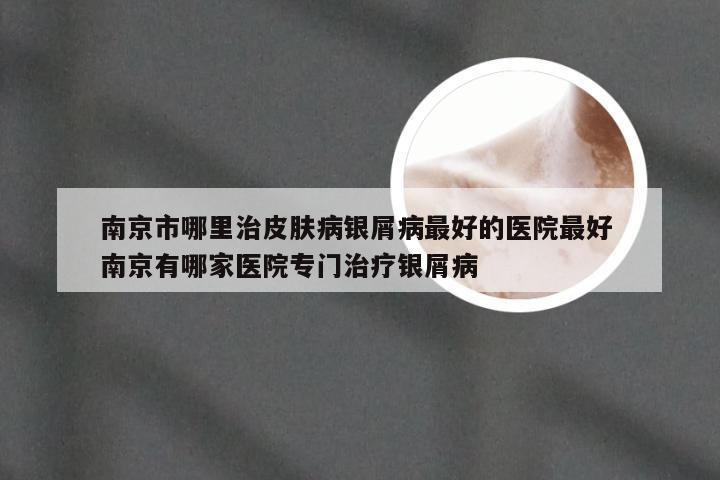 南京市哪里治皮肤病银屑病最好的医院最好 南京有哪家医院专门治疗银屑病