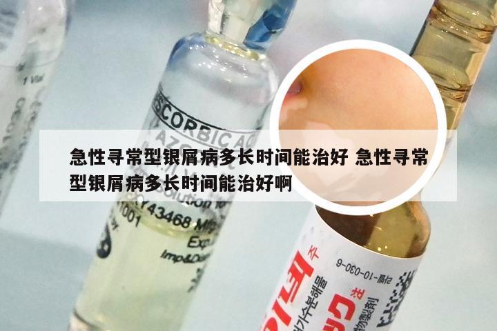 急性寻常型银屑病多长时间能治好 急性寻常型银屑病多长时间能治好啊