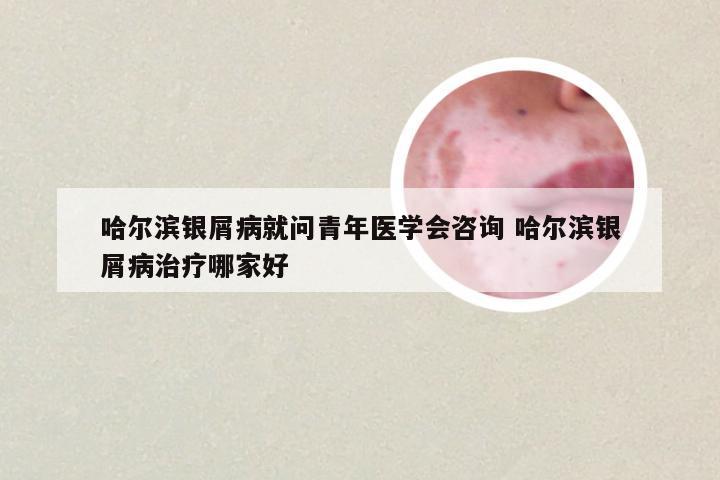 哈尔滨银屑病就问青年医学会咨询 哈尔滨银屑病治疗哪家好
