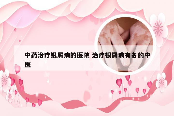 中药治疗银屑病的医院 治疗银屑病有名的中医