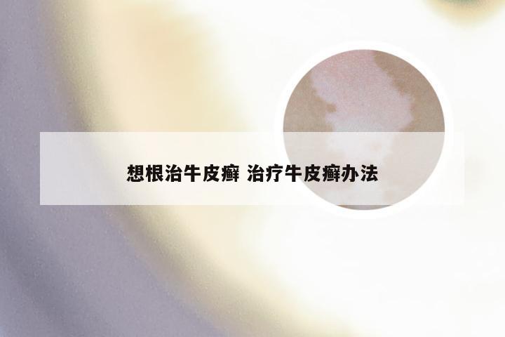 想根治牛皮癣 治疗牛皮癣办法