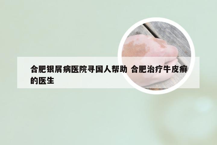 合肥银屑病医院寻国人帮助 合肥治疗牛皮癣的医生
