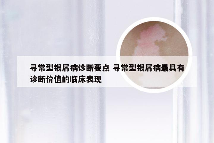 寻常型银屑病诊断要点 寻常型银屑病最具有诊断价值的临床表现