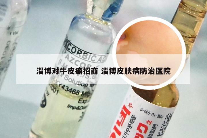 淄博对牛皮癣招商 淄博皮肤病防治医院