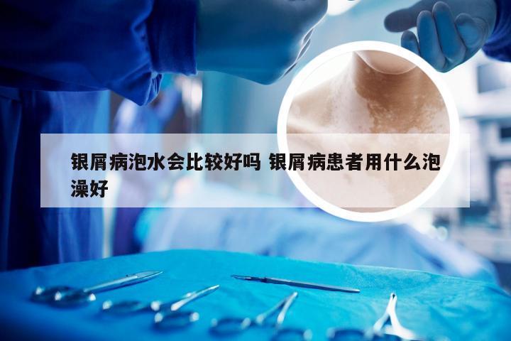 银屑病泡水会比较好吗 银屑病患者用什么泡澡好