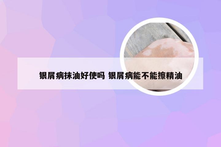 银屑病抹油好使吗 银屑病能不能擦精油