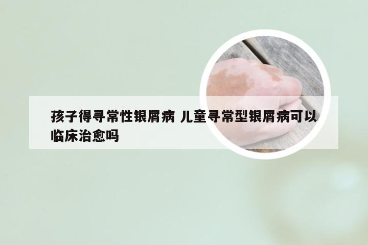 孩子得寻常性银屑病 儿童寻常型银屑病可以临床治愈吗